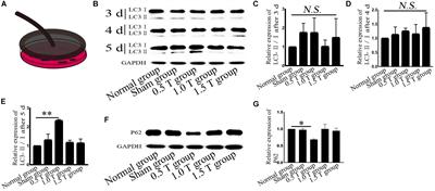 High-Frequency Repetitive Transcranial Magnetic Stimulation Mediates Autophagy Flux in Human Bone Mesenchymal Stromal Cells via NMDA Receptor–Ca2+–Extracellular Signal-Regulated Kinase–Mammalian Target of Rapamycin Signaling